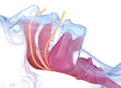 Curso corto de Apnea del Sueño
